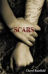 Scars